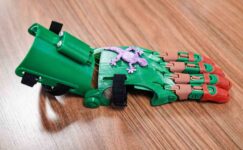 Büyükşehir çocuklara robot el ile umut olacak